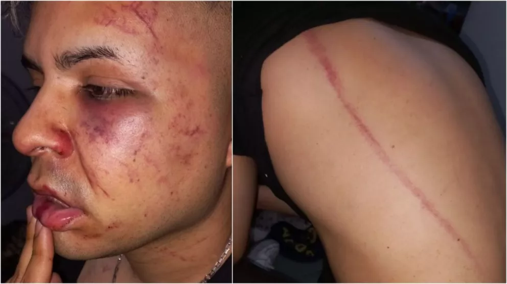 Tucumán: con un látigo, patovicas atacaron a una pareja que quería entrar a un boliche