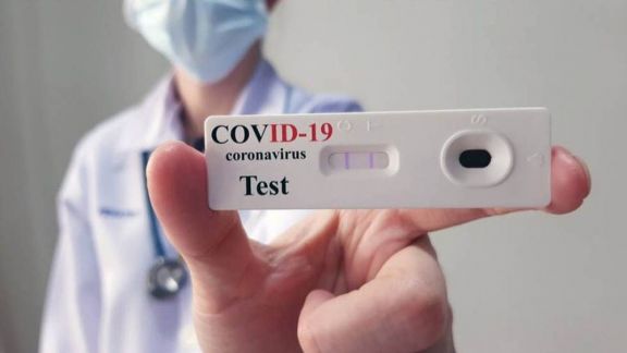 La Confederación Farmacéutica alertó que en noviembre se disparó la venta de autotest Covid