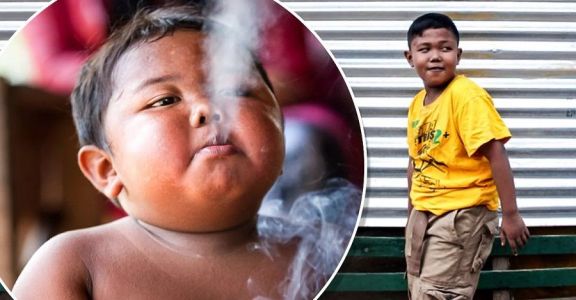 Así luce hoy Aldi Rizal, el bebé que fumaba 40 cigarrillos al día