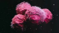Los factores de riesgo del cuarto tumor más diagnosticado en el mundo: cáncer de próstata