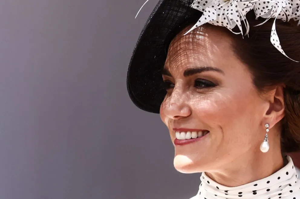 La familia real no quiere que se sepa: esta sería la explicación de la misteriosa cicatriz de Kate Middleton