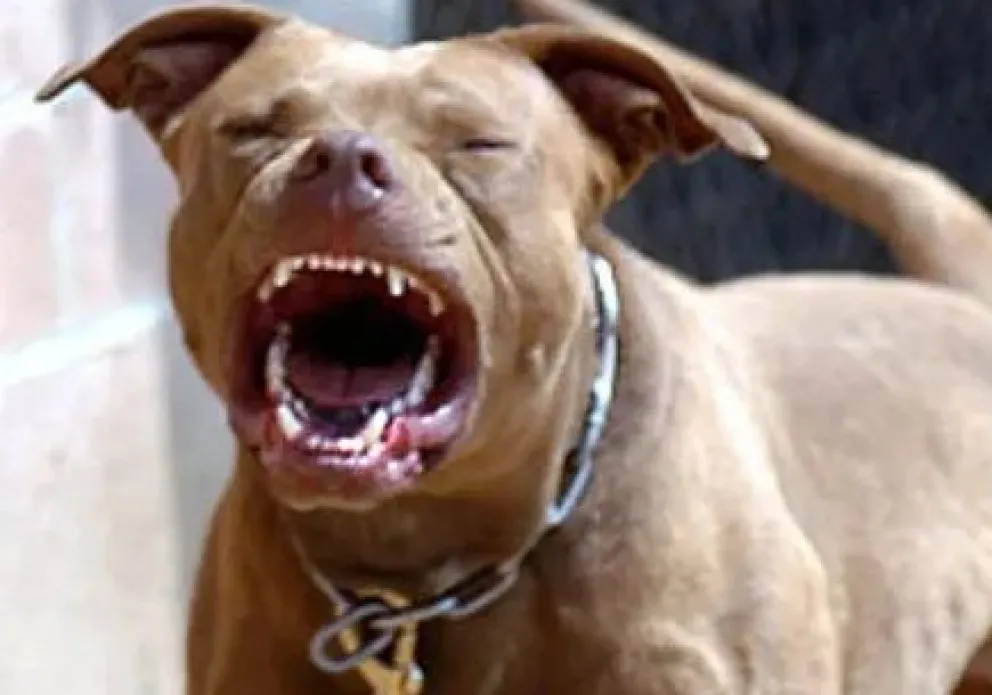 Una abuela y su nieta se encuentran en grave estado de salud tras ser atacadas por dos pitbulls